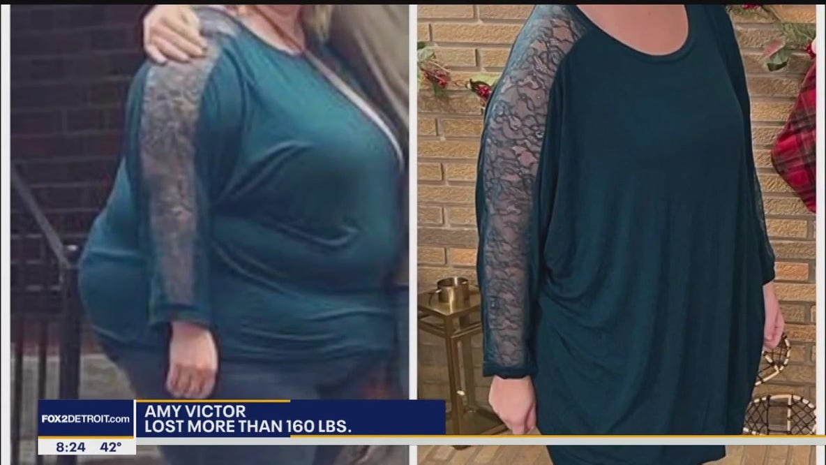 The Doctor Is In: Weight Loss Surgery